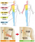 帶狀皰疹癥狀表現(xiàn)是什么樣的？